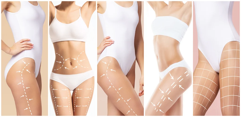 Schönheitsoperationen in der Türkei